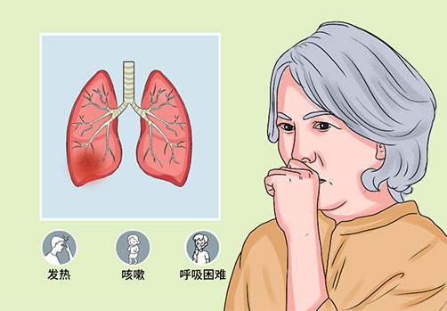 刘建博医生：肺气肿的中医治疗与调理